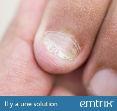 Brittle, crumbly or ragged nails. There is a solution: Emtrix